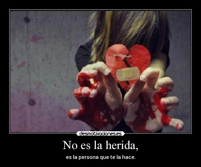 No es la herida, - es la persona que te la hace.