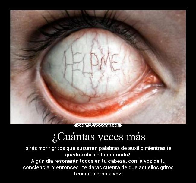 ¿Cuántas veces más - oirás morir gritos que susurran palabras de auxilio mientras te
quedas ahí sin hacer nada? 
Algún día resonarán todos en tu cabeza, con la voz de tu
conciencia. Y entonces...te darás cuenta de que aquellos gritos
tenían tu propia voz.