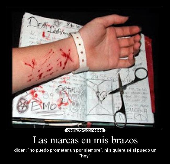 Las marcas en mis brazos - dicen: no puedo prometer un por siempre, ni siquiera sé si puedo un hoy.