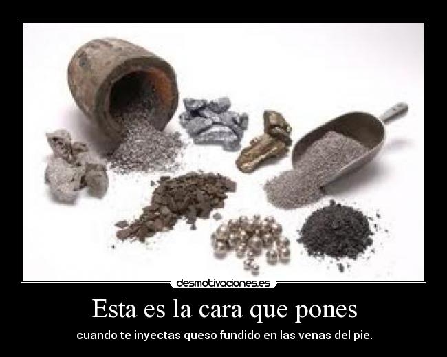 Esta es la cara que pones - cuando te inyectas queso fundido en las venas del pie.