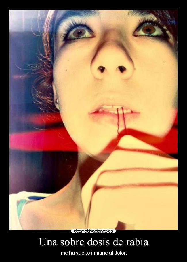 Una sobre dosis de rabia -
