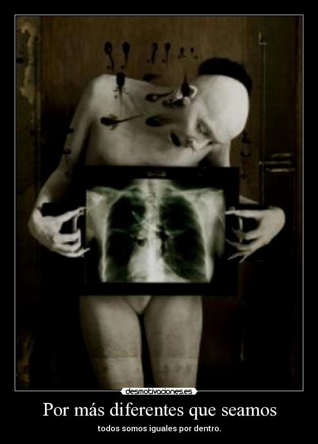 Por más diferentes que seamos -
