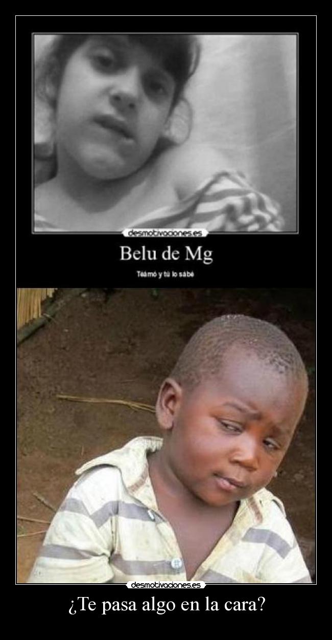 ¿Te pasa algo en la cara? - 