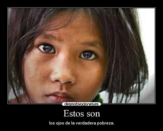 Estos son - los ojos de la verdadera pobreza.