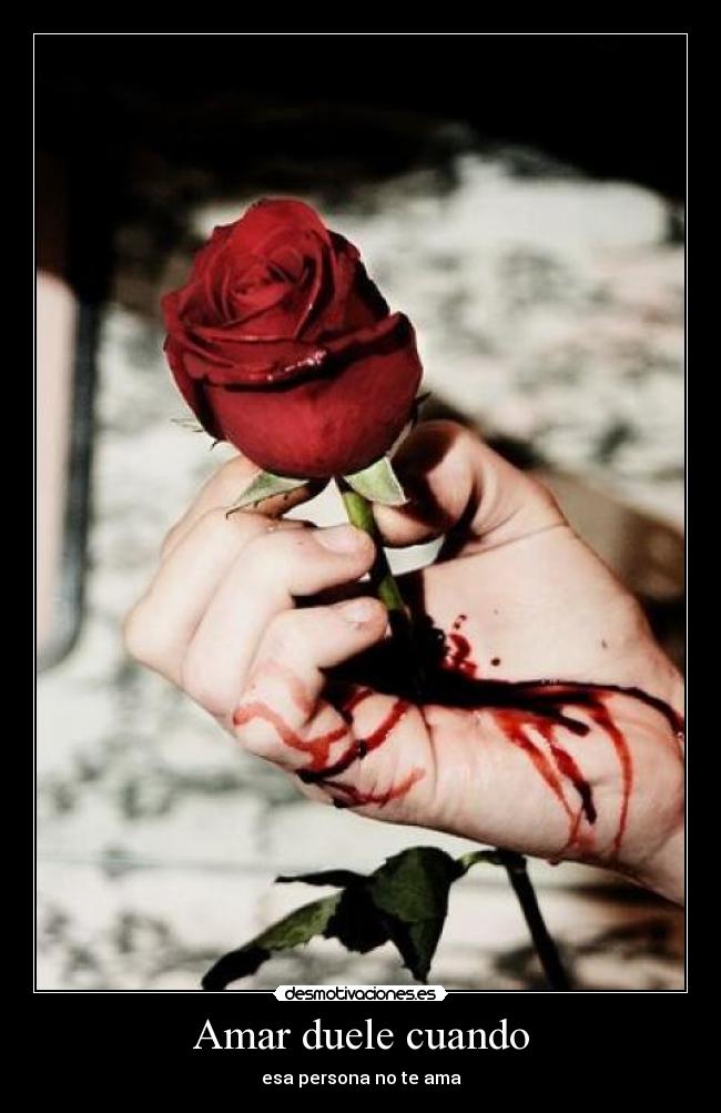 Amar duele cuando - esa persona no te ama