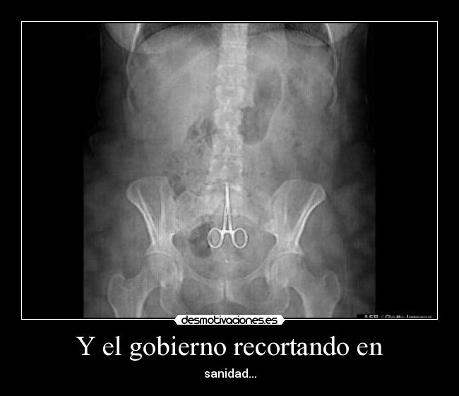 carteles chapuzon desmotivaciones