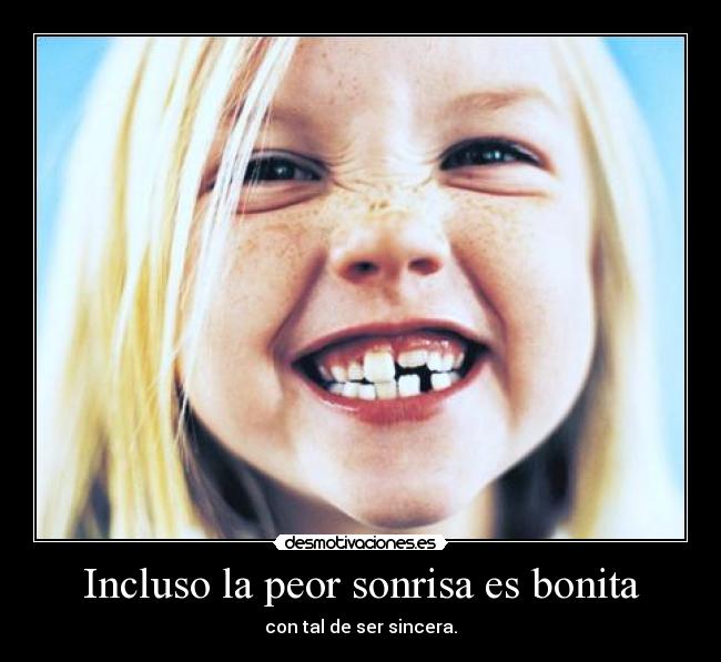 Incluso la peor sonrisa es bonita -