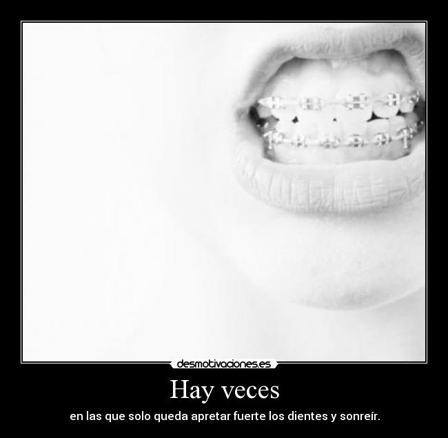 Hay veces - en las que solo queda apretar fuerte los dientes y sonreír.