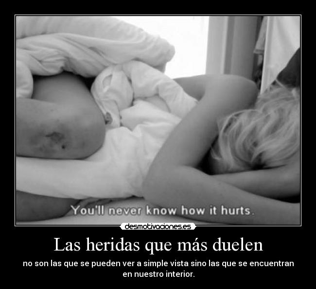 Las heridas que más duelen - no son las que se pueden ver a simple vista sino las que se encuentran
en nuestro interior.