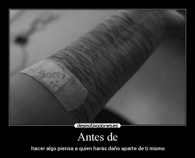 Antes de -