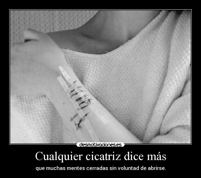 Cualquier cicatriz dice más - que muchas mentes cerradas sin voluntad de abrirse.