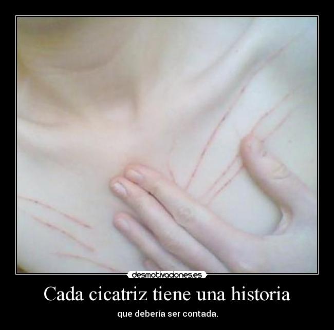 Cada cicatriz tiene una historia - que debería ser contada.