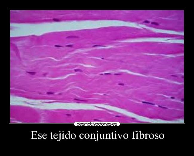 Ese tejido conjuntivo fibroso - 
