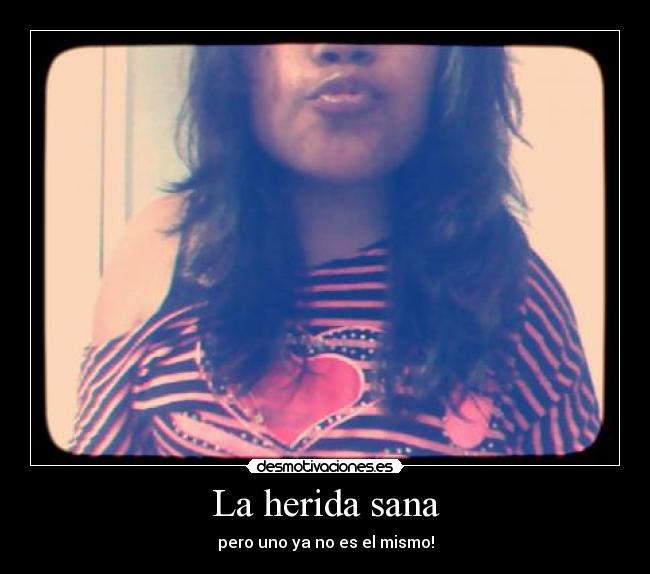La herida sana - pero uno ya no es el mismo!
