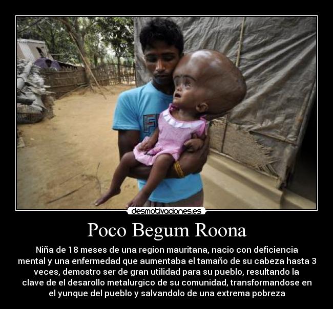 Poco Begum Roona - 