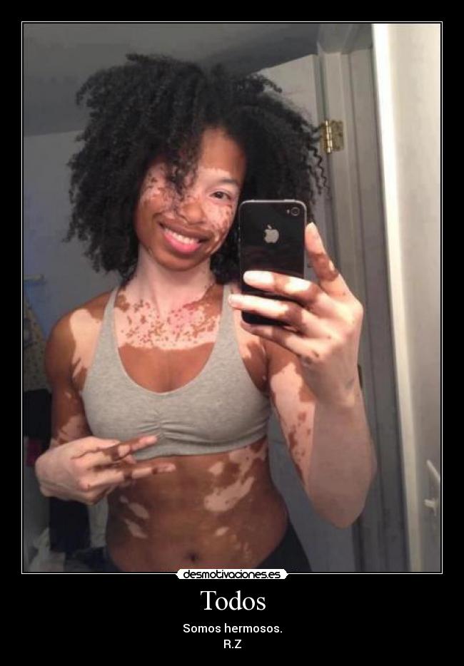 Todos - Somos hermosos.
R.Z