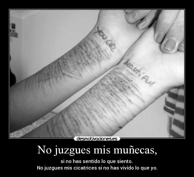 No juzgues mis muñecas, - si no has sentido lo que siento.
No juzgues mis cicatrices si no has vivido lo que yo.