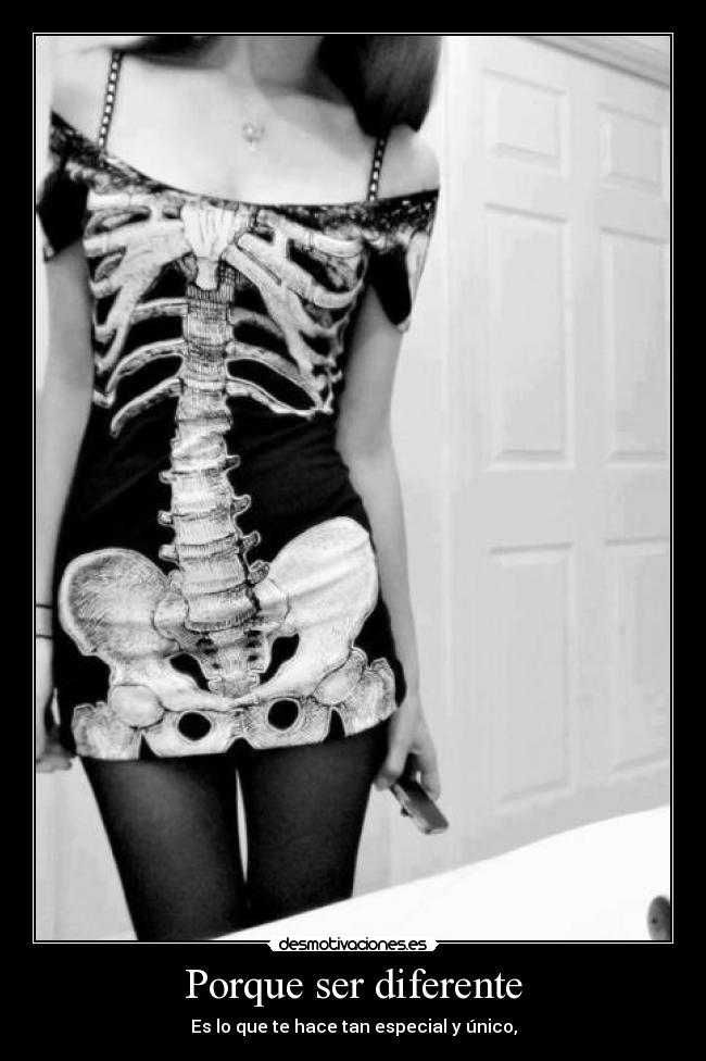 Porque ser diferente - Es lo que te hace tan especial y único,