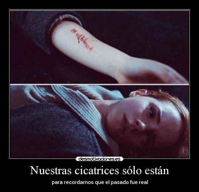 Nuestras cicatrices sólo están - para recordarnos que el pasado fue real