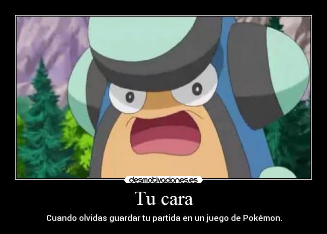 Tu cara - Cuando olvidas guardar tu partida en un juego de Pokémon.
