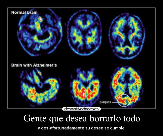 Gente que desea borrarlo todo - 