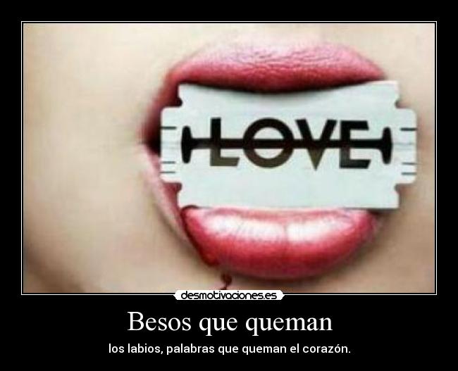 Besos que queman -