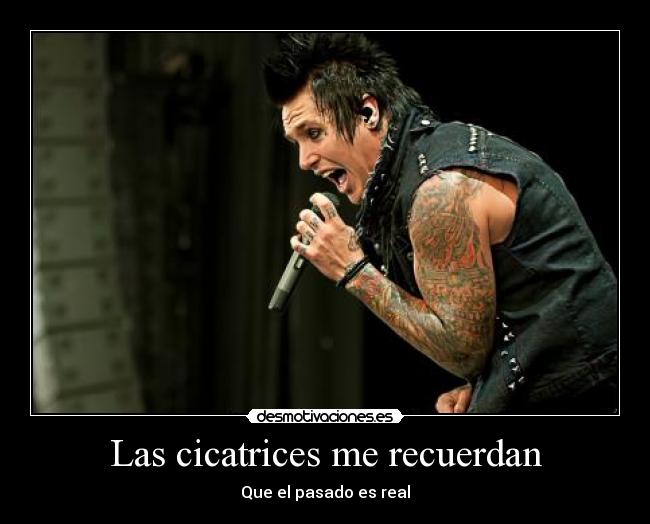 Las cicatrices me recuerdan - 