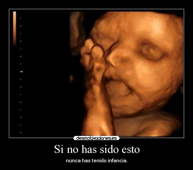 Si no has sido esto -