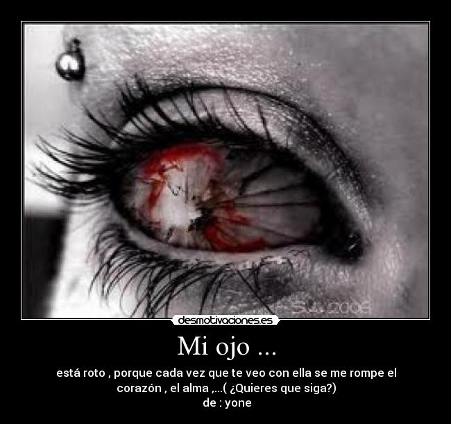 Mi ojo ... -