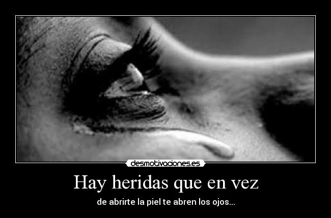 Hay heridas que en vez -