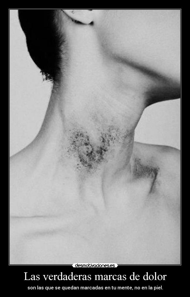 Las verdaderas marcas de dolor - son las que se quedan marcadas en tu mente, no en la piel.