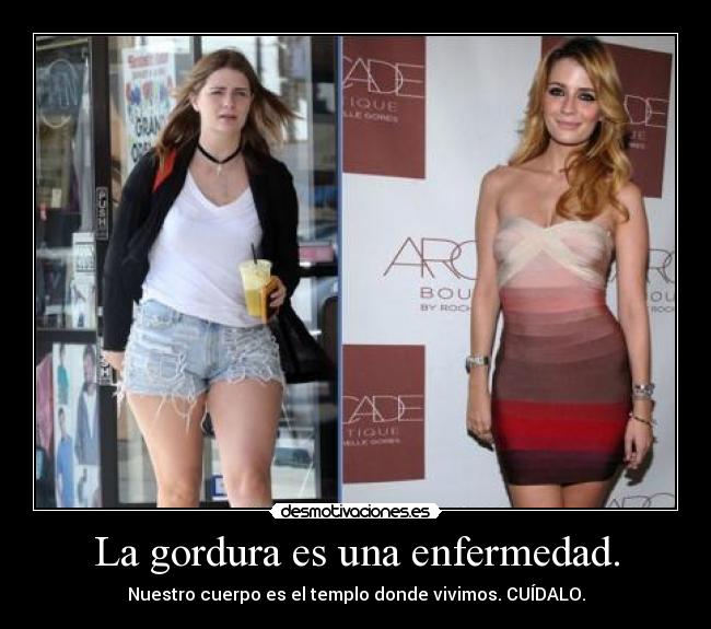 La gordura es una enfermedad. -