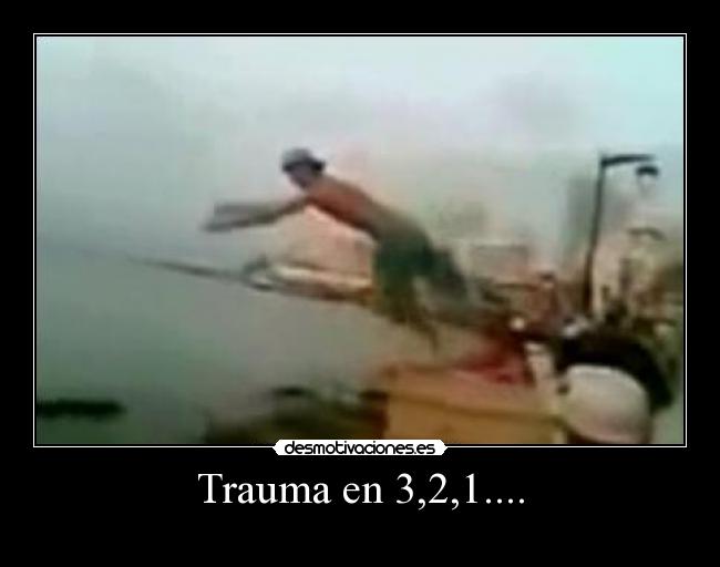 Trauma en 3,2,1.... - 