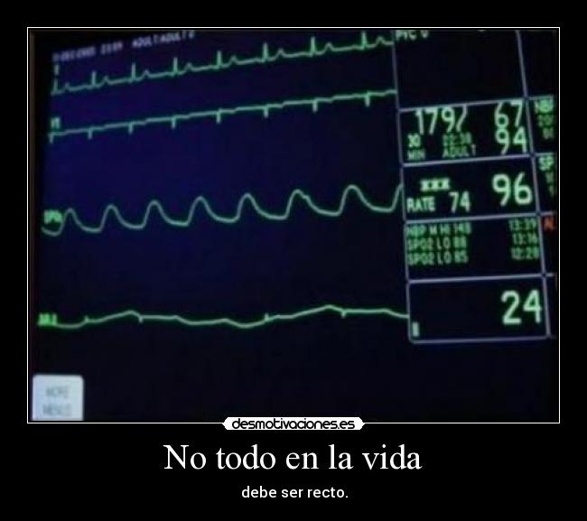 No todo en la vida - debe ser recto.