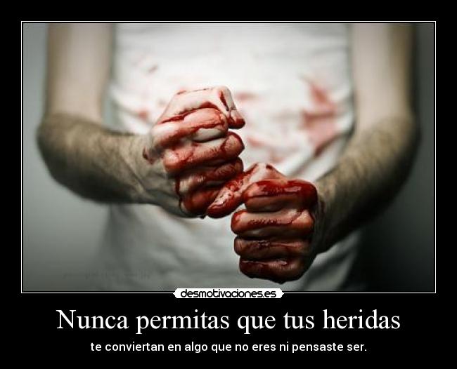 Nunca permitas que tus heridas - te conviertan en algo que no eres ni pensaste ser.