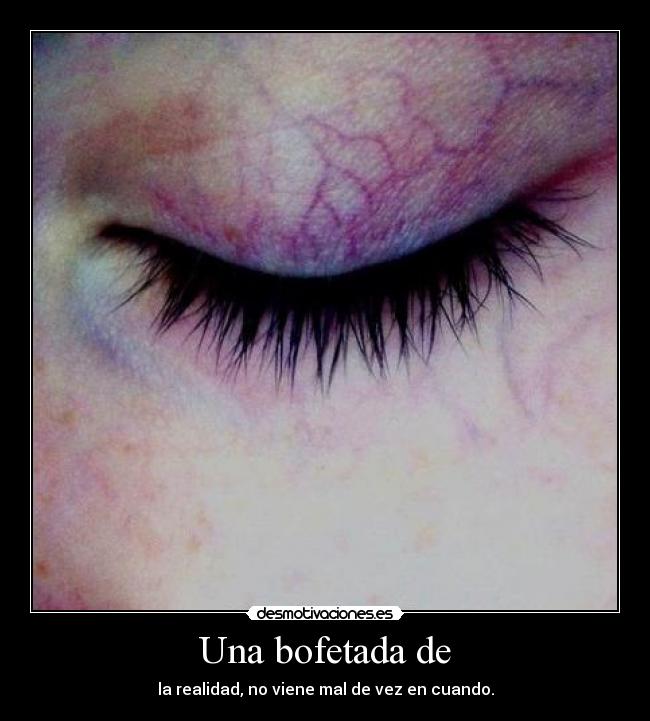 Una bofetada de - la realidad, no viene mal de vez en cuando.