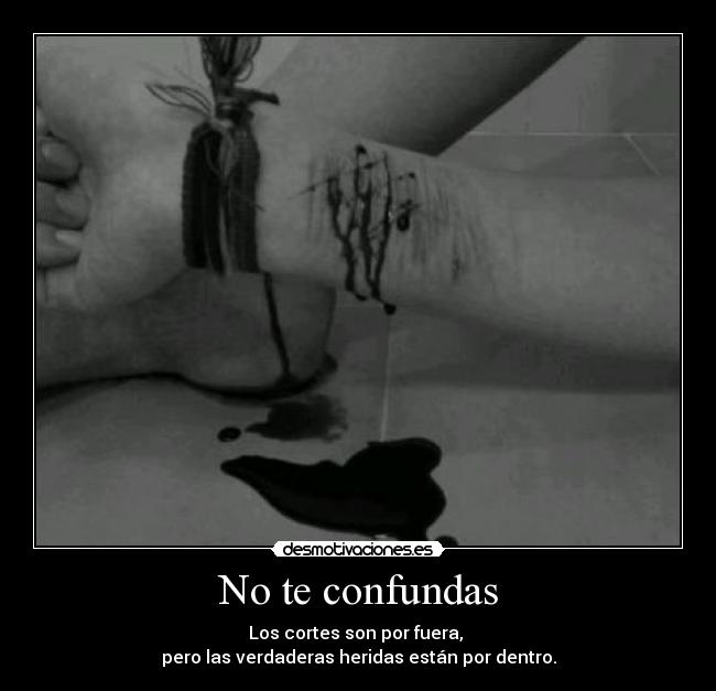 No te confundas - Los cortes son por fuera, 
pero las verdaderas heridas están por dentro.