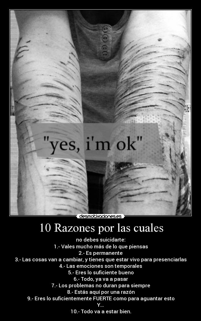 10 Razones por las cuales -