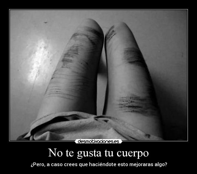 No te gusta tu cuerpo - ¿Pero, a caso crees que haciéndote esto mejoraras algo?
