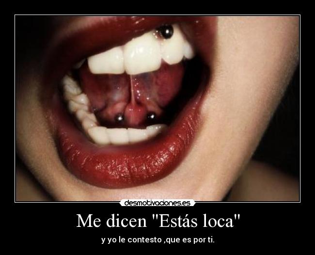 Me dicen Estás loca - y yo le contesto ,que es por ti.