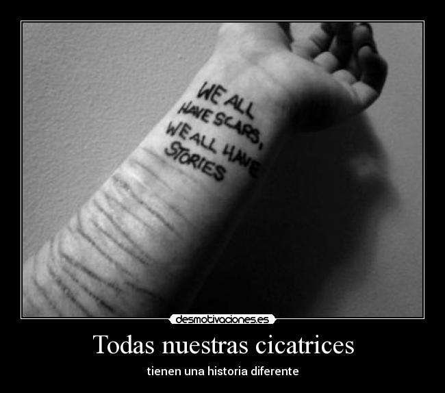 Todas nuestras cicatrices - tienen una historia diferente