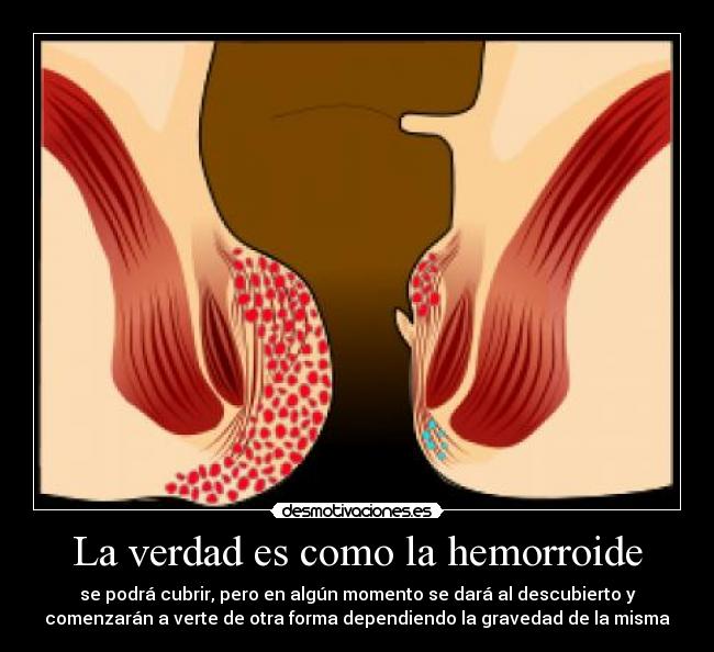 carteles las hemorroides pueden dejar mal como las mentiras dedicado sofa gaga desmotivaciones