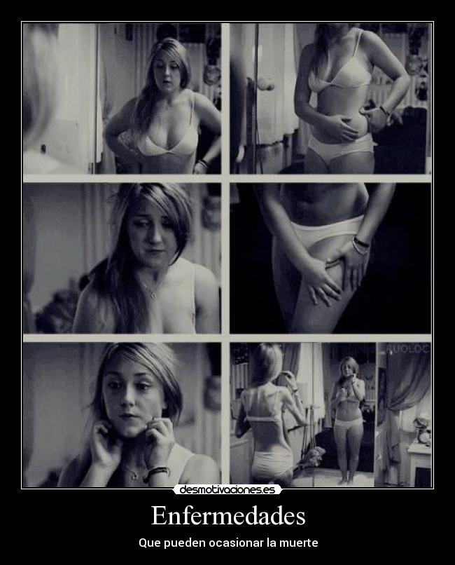 Enfermedades - Que pueden ocasionar la muerte