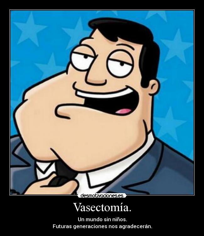 Vasectomía. - 