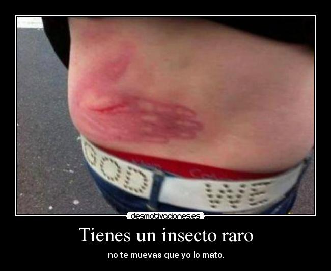 Tienes un insecto raro - no te muevas que yo lo mato.