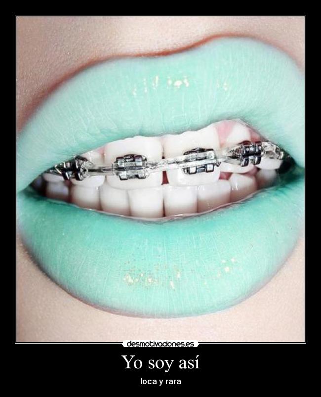 Yo soy así - loca y rara