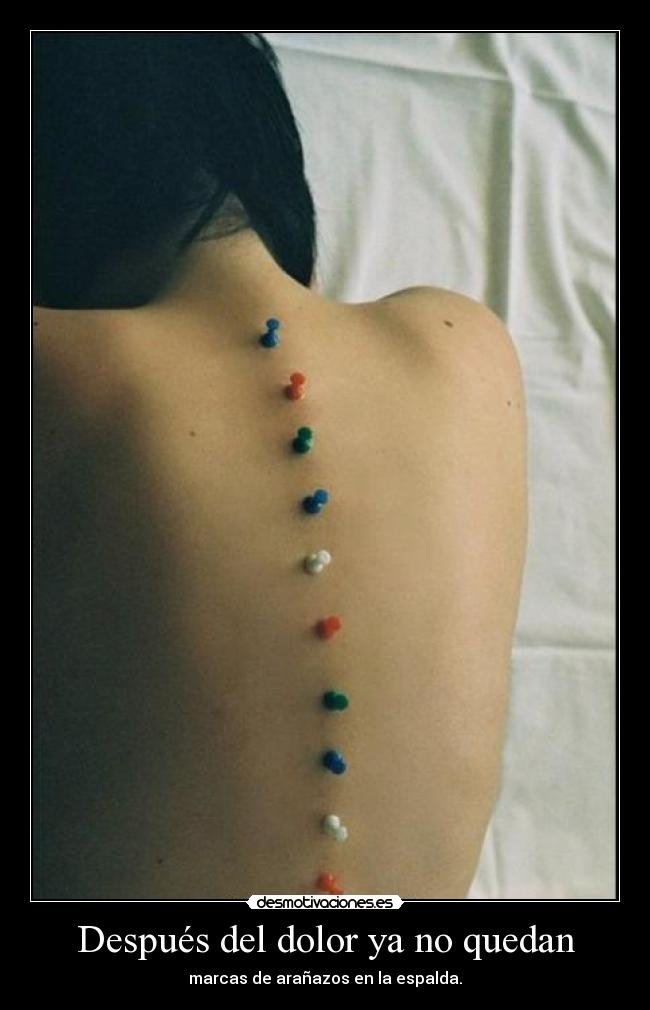 Después del dolor ya no quedan -