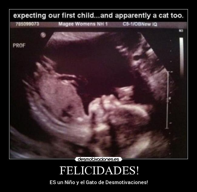 FELICIDADES! - ES un Niño y el Gato de Desmotivaciones!