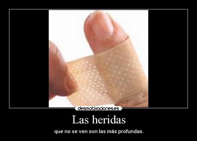 Las heridas - que no se ven son las más profundas.