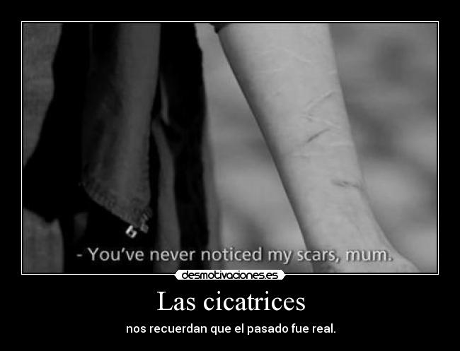 Las cicatrices - 